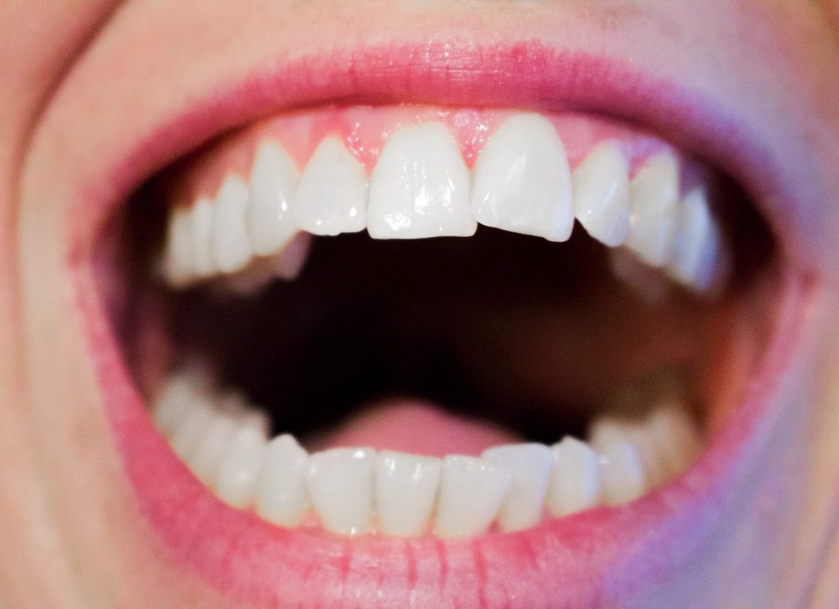 Obecna technologia używana w salonach stomatologii estetycznej może sprawić, że odzyskamy ładny uśmiech.